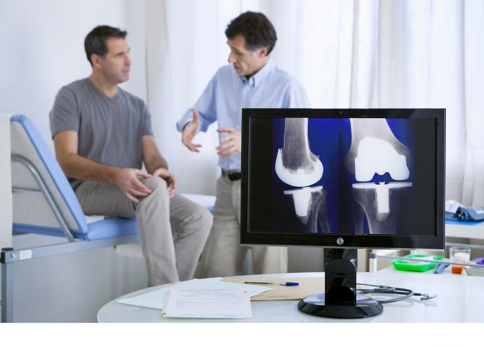 põlveliigese artroos X -RAY pildil